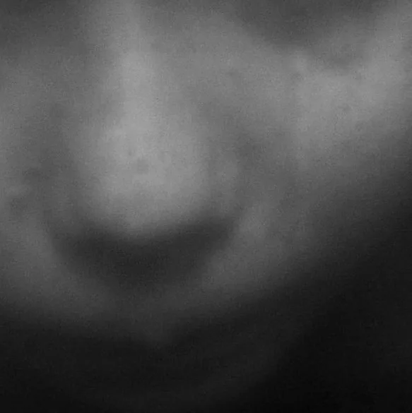 Eyes of Another
